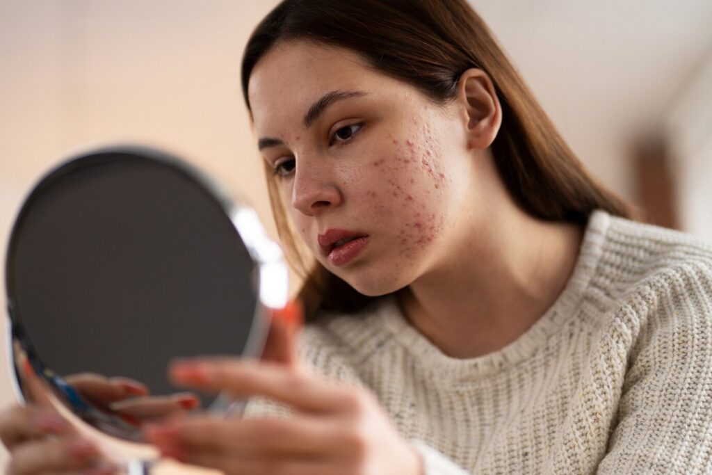 person-dealing-with-rosacea_23-2150478728